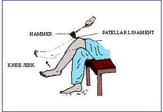 kneejerk_small.jpg